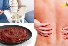 თქვენ შეძლებთ მოიცილოთ თიაქარი სახლის პირობებში, თუ ამ ნარევს წაისვამთ