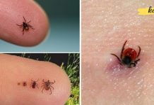 ამ ხერხით ძალიან მარტივად ამოიღებთ ტკიპას კანიდან. ამის ცოდნა აუცილებელია!