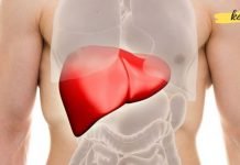 ეფექტური საშუალება ღვიძლის გასაწმენდად, ყურადღებით გაეცანით რეცეპტს და სცადეთ თქვენც!