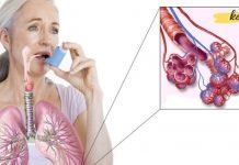 ეს რეცეპტი ასთმისა და ბრონქიტის პრობლემას სამუდამოდ დაგავიწყებთ. ეს მკურნალობის საუკეთესო გზაა