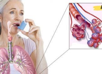 ეს რეცეპტი ასთმისა და ბრონქიტის პრობლემას სამუდამოდ დაგავიწყებთ. ეს მკურნალობის საუკეთესო გზაა