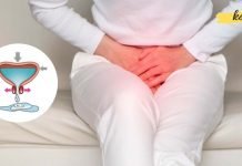 შარდის შეუკავებლობა, ხშირი შარდვა, შარდის ბუშტის გაღიზიანება