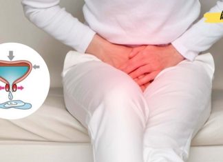 შარდის შეუკავებლობა, ხშირი შარდვა, შარდის ბუშტის გაღიზიანება