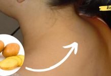 თუ კისერზე მარილები დაგიგროვდათ კარტოფილის კომპრესი ტკივილს სამუდამოდ მოგიხსნით!