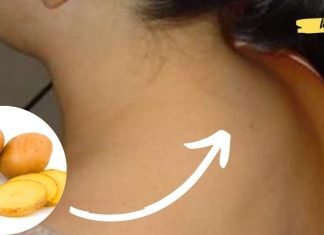 თუ კისერზე მარილები დაგიგროვდათ კარტოფილის კომპრესი ტკივილს სამუდამოდ მოგიხსნით!