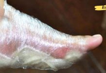 აი, რა მოხდება თუ ხახვს ფეხებზე დაიდებთ. საჭირო ინფორმაცია, რომელიც ბევრისთვის უცნობია