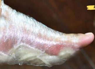 აი, რა მოხდება თუ ხახვს ფეხებზე დაიდებთ. საჭირო ინფორმაცია, რომელიც ბევრისთვის უცნობია