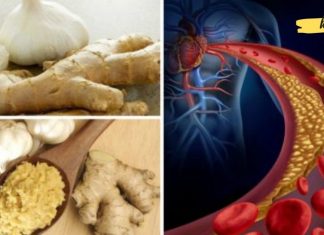 ეს მეთოდი დაგეხმარებათ ქოლესტერინისა და წნევის დარეგულირებაში! სანამ აფთიაქში წახვალთ წამლების შესაძენად სცადეთ ეს რეცეპტი