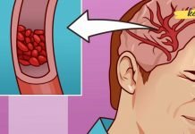 მაგნიუმის დეფიციტის სიმპტომები, რომლებსაც ადამიანების 90% ყურადღებას არ აქცევს