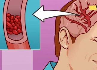 მაგნიუმის დეფიციტის სიმპტომები, რომლებსაც ადამიანების 90% ყურადღებას არ აქცევს