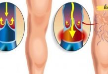 დალიეთ მცენარეული ჩაი ფეხებში სისხლის მიმოქცევის გასაუმჯობესებლად