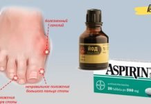 იოდისა და ასპირინის ნარევი გაგათავისუფლებთ პოდაგრისგან! გირჩევთ სცადოთ..