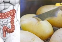 გაიწმინდეთ ორგანიზმი მარტივად კარტოფილითა და კეფირით. გამოგადგებათ