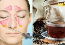 მოიშორეთ ჰაიმორიტი შავი ჩაის გამოყენებით! ნაცადი მეთოდია