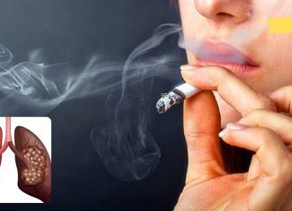 თუ ეწევით გამოიყენეთ ეს საშუალება თქვენი ფილტვებიდან მოწევის შედეგად დარჩენილი ნარჩენების გასასუფთავებლად!