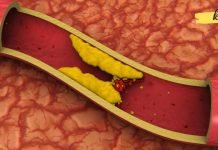 ეს პროდუქტები საოცრად ეხმარება არტერიებს ბაქტერიების გამოდევნაში. უმოკლეს დროში აჯანსაღებს არტერიებს.