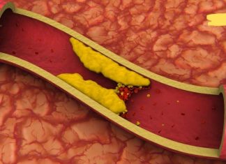 ეს პროდუქტები საოცრად ეხმარება არტერიებს ბაქტერიების გამოდევნაში. უმოკლეს დროში აჯანსაღებს არტერიებს.