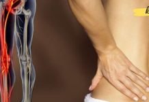 ხელნაკეთი რეცეპტები, რომლებიც ხელს უწყობენ საჯდომის ნერვის ბლოკირების ან ანთების მკურნალობას