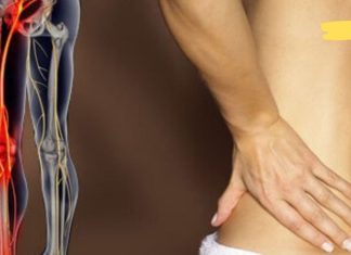 ხელნაკეთი რეცეპტები, რომლებიც ხელს უწყობენ საჯდომის ნერვის ბლოკირების ან ანთების მკურნალობას