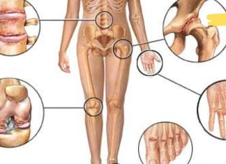 სახსრებისა და ძვლების გასამაგრებელი უნიკალური რეცეპტი, რომელიც აუცილებლად უნდა სცადოთ!