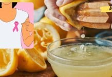 ლიმონი ქიმიოთერაპიაზე 10000-ჯერ უფრო ძლიერია! ეს უნდა იცოდე!