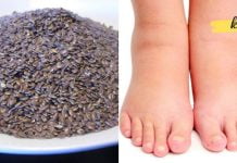 აი რა უნდა გააკეთოთ თუ ფეხები ხშირად გიშუპდებათ!