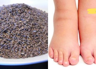 აი რა უნდა გააკეთოთ თუ ფეხები ხშირად გიშუპდებათ!