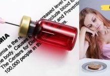 ანემიის დამახასიათებელი ნიშნები და მკურნალობა აიურვედას მეთოდებით