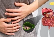 როგორ განვკურნოთ ნაღვლის ბუშტი და ღვიძლი ბუნებრივად? ეს ინფორმაცია ბევრს გამოადგება