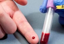 როგორ შეიძლება გავითხელოთ სისხლი სახლის პირობებში? ეს ძალიან გამოგადგებათ!