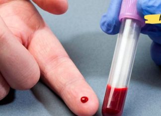 როგორ შეიძლება გავითხელოთ სისხლი სახლის პირობებში? ეს ძალიან გამოგადგებათ!