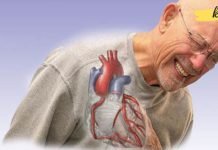 ექიმებმა არტერიების დახშობის ძირითადი ნიშნები დაასახელეს