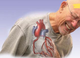 ექიმებმა არტერიების დახშობის ძირითადი ნიშნები დაასახელეს