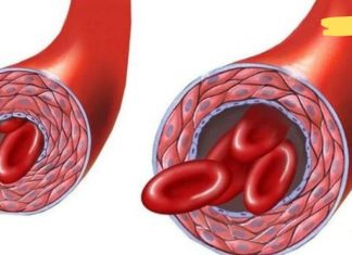 8 საკვები, რომელიც ამცირებს გაჯერებული ქოლესტერინის დონეს და აუმჯობესებს სისხლის მიმოქცევის ფუნქციას