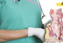 ყველაზე ეფექტური ხალხური საშუალება ბუასილის სამკურნალოდ