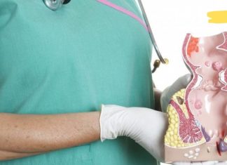 ყველაზე ეფექტური ხალხური საშუალება ბუასილის სამკურნალოდ