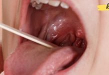 ჯადოსნური რეცეპტი სინუსიტის, ანგინისა და სხვადასხვა ინფექციების დროს! შეებრძოლე ვირუსებს ხალხური მეთოდებით!