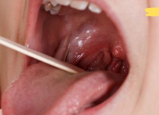 ჯადოსნური რეცეპტი სინუსიტის, ანგინისა და სხვადასხვა ინფექციების დროს! შეებრძოლე ვირუსებს ხალხური მეთოდებით!