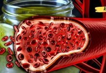 აი როგორ უნდა გავასუფთავოთ ქოლესტერინი სისხლძარღვებიდან 40 დღეში