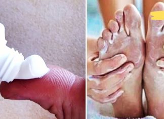 წაისვით კბილის პასტა ძილის წინ ფეხებზე ბზარებს მოსაშორებლად!