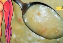 ამ მეთოდის გამოყენების შემდეგ საჯდომის ნერვის ანთებას აღარ შევუწუხებივარ. თქვენც გირჩევთ!