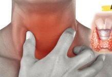 ეს ნიშნები მიუთითებს ფარისებრი ჯირკვლის დაავადებაზე: 13 სიმპტომი რომელსაც ყურადღება უნდა მიაქციოთ!