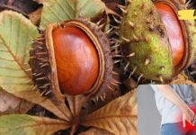 უმკურნალეთ ბუასილს ბუნებრივი საშუალებებით! ეფექტურია