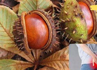 უმკურნალეთ ბუასილს ბუნებრივი საშუალებებით! ეფექტურია