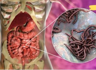 4 რეცეპტი, რომელიც დაგეხმარებათ ორგანიზმიდან პარაზიტების მოცილებაში ძალიან მოკლე ხანში! უნდა სცადოთ!