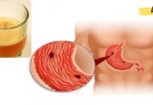 თუ კუჭის წყლული გაწუხებთ, ეს სასმელი დაგეხმარებათ ტკივილის შემსუბუქებაში!