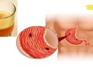 თუ კუჭის წყლული გაწუხებთ, ეს სასმელი დაგეხმარებათ ტკივილის შემსუბუქებაში!