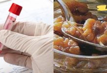 თუ დაბალი ჰემოგლობინი გაქვთ, გამოიყენეთ ეს საშუალებები! ისინი სწრაფად გაგიზრდით!