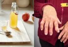 რევმატოიდული ართრიტის ბუნებრივი სამკურნალო საშუალებები. უბრალოდ გააკეთეთ და დაივიწყეთ ტკივილები!