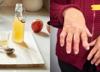 რევმატოიდული ართრიტის ბუნებრივი სამკურნალო საშუალებები. უბრალოდ გააკეთეთ და დაივიწყეთ ტკივილები!